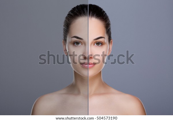 Comparison portrait of\
woman. Divided face of woman. One half of face with acne, before.\
Another half of face with retouch, after. Studio, head and\
shoulders, indoors 
