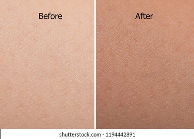 Comparison Portrait Of Woman Skin Color Texture After Use Tan Spray