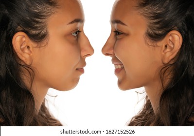 Comparison Portrait Of Young Latin Woman Before And After Nose Job On White Background