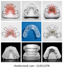 Compilation Picture Of Essix Retainer Surrounded By Orthodontic Appliances And Study Models