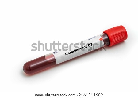 Complement C3 Medical check up test tube with biological sample