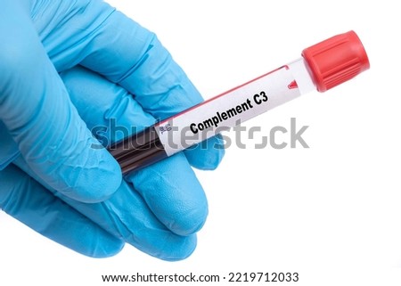 Complement C3 Medical check up test tube with biological sample
