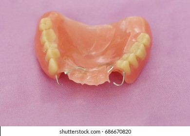 Complete denture or removable prosthesis, Temporary plate