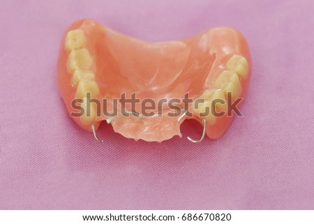 Complete denture or removable prosthesis, Temporary plate