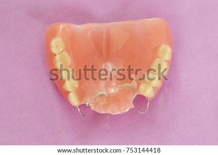 Complete denture or removable prosthesis, Temporary plate