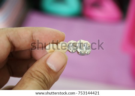 Complete denture or removable prosthesis, Temporary plate