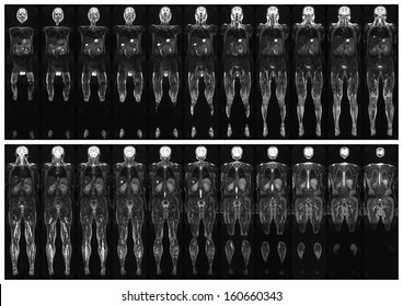 Complete Real MRI Scan Of The Human Body, From The Front And Back