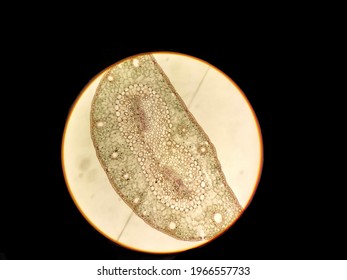 Components Of Pine Needles At The Cellular Level. Preparation Of Pine Needles (leaf Changes) Pine Cross Section Through A Microscope