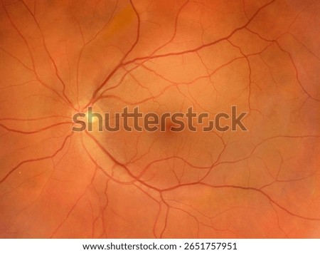 A composite view of a normal retina