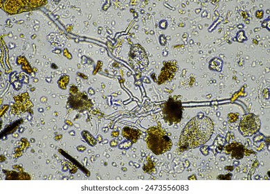 compost microorganisms under a microscope including amoeba, flagellates, nematodes, fungi, bacteria
