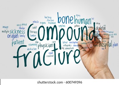 Compound Fracture Word Cloud Concept On Grey Background.