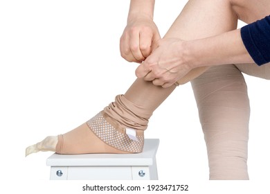 Compression Garments For The Treatment Of Lipoedema And Lymphoedema.Lymphedema Management: Wrapping Leg Using Multilayer Bandages To Control Lymphedema. Part Of Complete Decongestive Therapy (cdt