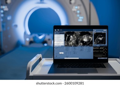 Computed tomography scan mock-up with multiple windows and data. Medical research environment software with CT scan results for computer displays and laptop screens. Banner, advertising medicine