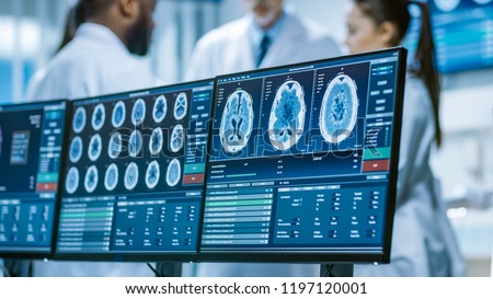 Computer Screen Showing MRI, CT Image Scan of the Brain. In the Background Meeting of the Team of  Medical Scientists in the Brain Research Laboratory. Neurologists / Neuroscientists Having Discussion