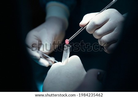 concentrated professional surgical doctor team operating surgery a patient in the operating room at hospital. tumor cancer. surgical biopsy specimens. healthcare and medical concept.