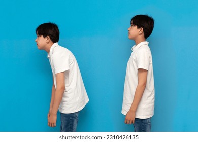 concept of bad posture, boy of twelve years old stoop on blue isolated background, comparison of bad and good posture, problem with the back and spine of child