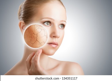 Concept Of Cosmetic Effects, Treatment And Skin Care.  Face Of Young Woman With Dry Skin