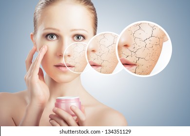 Concept Of Cosmetic Effects, Treatment And Skin Care.  Face Of Young Woman With Dry Skin