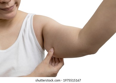 Concept of cosmetic surgery for removing excess fat and cellulite from under the skin,young female is touching her large arms,showing the sagging layer of fat from her upper arm from shoulder to elbow - Shutterstock ID 1975515167