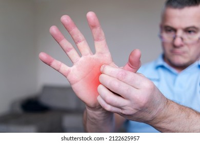 The concept of dermatitis, eczema, allergies, psoriasis. A man scratching an itchy hand. Close-up of a man with an itchy rash on his arm, the affected area is highlighted in red.