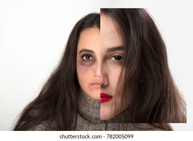 Concept Domestic Violence Keeping Appearances Battered Stock Photo ...
