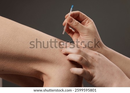 concept dry needling method. Acupuncture treatment close-up. Therapist inserting a thin needle into patient's skin for alternative therapy, pain relief, and wellness.