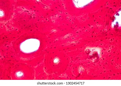 Compact Bone Tissue Images, Stock Photos & Vectors | Shutterstock