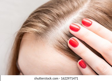 Concept of hair loss. Woman looks at hair loss, close up - Shutterstock ID 1622971471