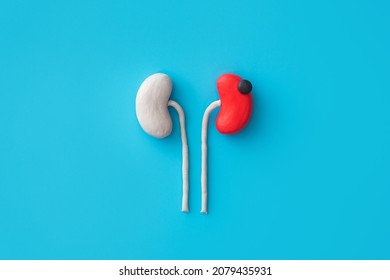 concept - kidney tumor. Kidney disease. - Shutterstock ID 2079435931