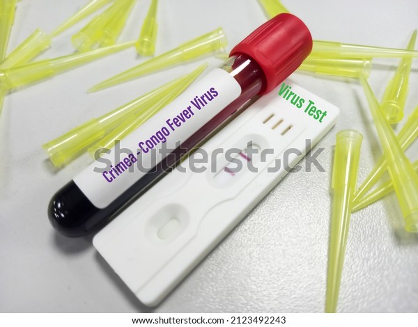 Concept of\
Laboratory test tube and rapid test kit for Crimea Congo\
hemorrhagic fever virus test or CCHF\
test.
