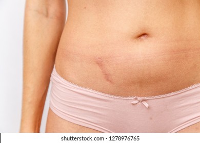 Hair Loss Anatomy Images Stock Photos Vectors Shutterstock