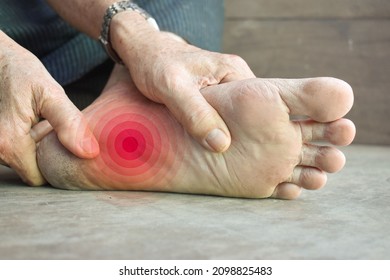 Concept of nail prick and cellulitis in foot of Asian young man. Sensory neuropathy problems. Foot nerves problems. Plantar fasciitis.