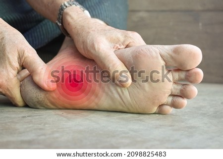 Concept of nail prick and cellulitis in foot of Asian young man. Sensory neuropathy problems. Foot nerves problems. Plantar fasciitis. Stock photo © 