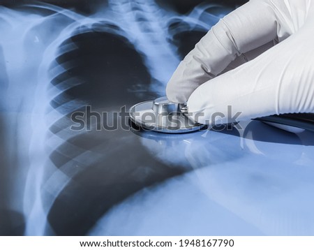 Concept od lung examination for diagnosis of lungs cancer and tuberculosis. Hand in medical gloves with stethoscope on chest radiography rtg xray image. Prevent and treat pulmonary diseases