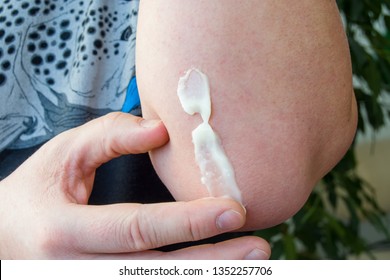 Concept photo of treatment of skin diseases using ointments as dosage form of drug. Patient causes medical therapeutic ointment thick consistency or cream moisturizer on skin in elbow area close-up  - Shutterstock ID 1352257706