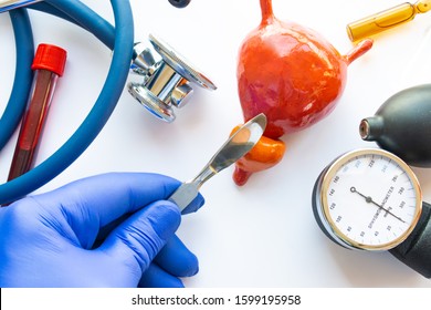 Concept Photo Of Urological Surgery, Operation On Prostate Or Bladder. Doctor With Scalpel In His Hand Makes  Incision In Figure Of Human Prostate, Which Is Located Near Medical Toolkit - Stethoscope