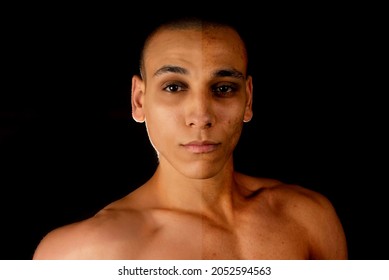 The Concept Of Skin Care Before, After. Young Egytian Man With Bad Skin With Wrinkles And Acne And After With Perfect Skin. Comparison Of The Result On Black Background.