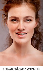 Concept Skincare And Teeth Whitening, Plastic Surgery,botox, Hyaluronic Acid. Skin Of Beauty Young Beautiful Woman Before And After The Procedure On  Grey Background