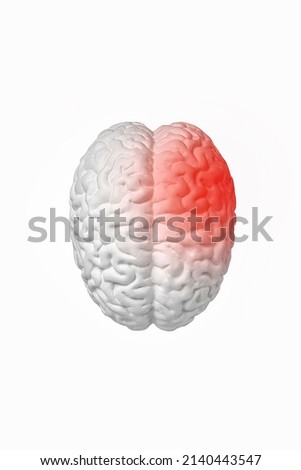 The concept of stroke, headache, top view of the human brain isolated on white background. Neurosurgery and medical care for brain problems