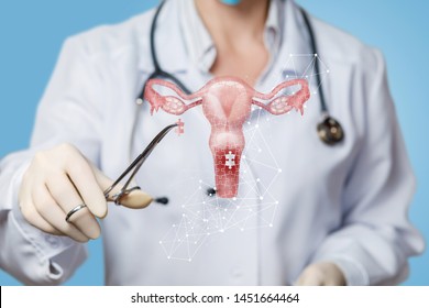 The Concept Of Surgical Treatment Of The Female Uterus.