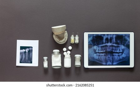 Concept of timely dental treatment. Plain x-ray of all teeth on tablet and separate x-ray of diseased tooth, cast of the jaw and prophylactic calcium tablets on dark brown background. Copy space - Shutterstock ID 2162085251