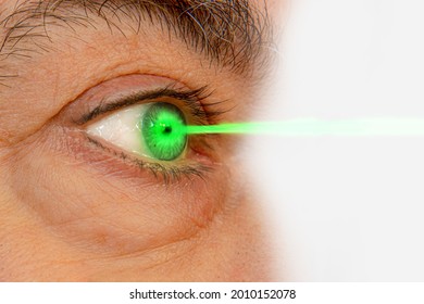 Concept of traitement by laser in opthalmology. Green laser beam and eye close-up.