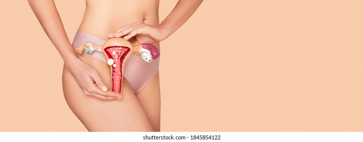 Concept treatment diseases uterus and ovaries, menstruation. Woman holding the anatomical model of uterus and ovaries with pathology on a beige background