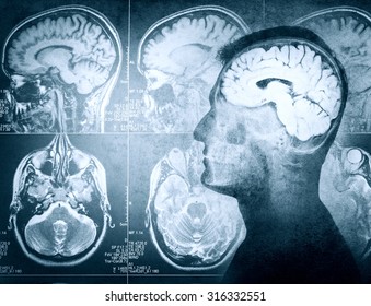 Conceptual Image Of A Man From Side Profile Showing Brain And Brain Activity. Retro Stale.