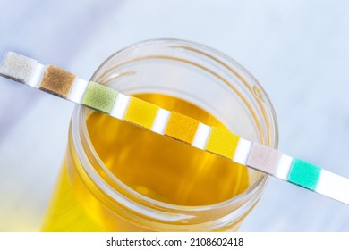 Conceptual Image On Urin Alysis, Dipstick Placed On The Vials Of Urine