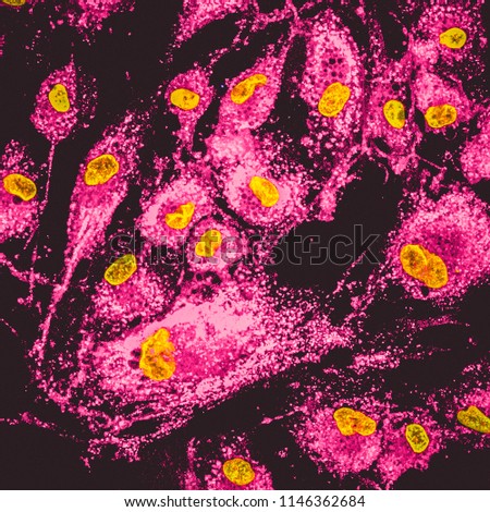 Confocal image of mitochondria in the mesenchymal steam cells. Mitochondrias are labeled with pink staining, cells nuclei are in yellow