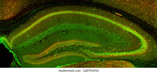 Confocal laser scanning microscope image of cells in the hippocampus of the mouse brain