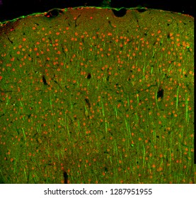 Confocal laser scanning microscope images of cells in the cerebral cortex of the mouse
