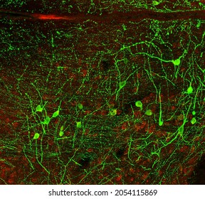 Confocal laser scanning microscopy image of immunofluorescence- labelled cells in the ventral tegmental area of the mouse brain