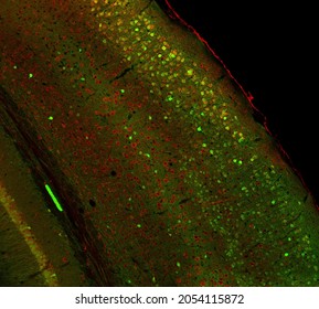 Confocal laser scanning microscopy image of immunofluorescence- labelled cells in the cerebral cortex of the mouse brain